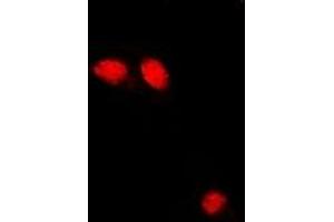 Immunofluorescent analysis of Troponin C staining in U2OS cells. (Troponin C Antikörper)