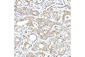 Immunohistochemistry of paraffin-embedded Human liver using RMDN3 Rabbit pAb (ABIN6127274, ABIN6146979, ABIN6146981 and ABIN6221512) at dilution of 1:100 (40x lens). (RMDN3 Antikörper  (AA 171-470))