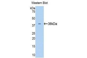 Western Blotting (WB) image for anti-Lactate Dehydrogenase B (LDHB) (AA 1-334) antibody (ABIN1174942) (LDHB Antikörper  (AA 1-334))