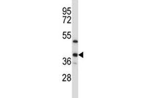 ERCC1 antibody western blot analysis in T47D lysate (ERCC1 Antikörper  (AA 268-297))