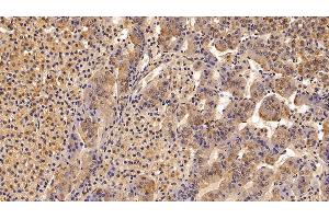 Detection of TBG in Porcine Adrenal gland Tissue using Polyclonal Antibody to Thyroxine Binding Globulin (TBG) (SERPINA7 Antikörper  (AA 128-415))