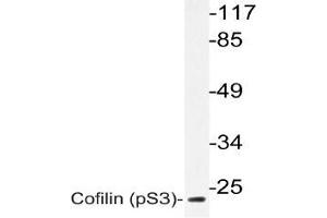 Western blot (WB) analyzes of p-Cofilin antbody in extracts from 3T3 paclitaxel cells. (Cofilin Antikörper  (pSer3))