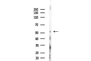 Western blot analysis of lysates from 293 cells(starvation 24h treatment), using VEGFR1 Antibody at 1/1000 dilution.