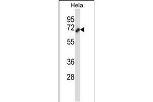 Western blot analysis in Hela cell line lysates (35ug/lane). (Cortactin Antikörper  (AA 273-302))