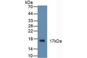 Figure. (CST6 Antikörper  (AA 29-149))