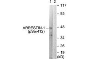 Western blot analysis of extracts from COS7 cells treated with Etoposide 25uM 60', using Arrestin 1 (Phospho-Ser412) Antibody. (SAG Antikörper  (pSer412))