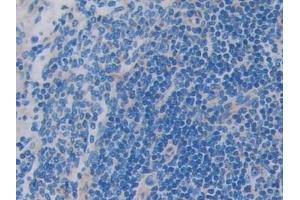 Immunohistochemistry (IHC) image for anti-Single Immunoglobulin and Toll-Interleukin 1 Receptor (TIR) Domain (SIGIRR) (AA 1-118) antibody (ABIN7437206)