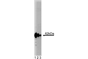 Western blot analysis of p62 Ick ligand on a HCT-8 (human colorectal adenocarcinoma, ATCC CCL-244) cell lysate. (p62 Lck Ligand (AA 257-437) Antikörper)