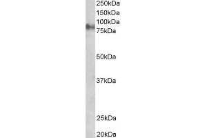 Western Blotting (WB) image for anti-Junction Plakoglobin (JUP) (C-Term) antibody (ABIN184775)
