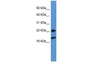 WB Suggested Anti-RPS27A  Antibody Titration: 0. (RPS27A Antikörper  (Middle Region))