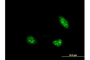 Immunofluorescence of monoclonal antibody to PIM1 on HeLa cell. (PIM1 Antikörper  (AA 1-100))
