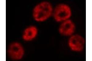 ABIN6275312 staining Hela by IF/ICC. (SP100 Antikörper  (Internal Region))