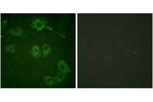 Immunofluorescence analysis of HuvEc cells, using COT (Ab-290) Antibody. (CROT Antikörper  (AA 256-305))
