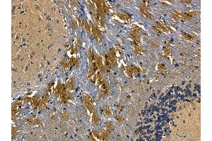 MLC1 Antibody at 1/100 staining mouse brain tissue by IHC-P. (MLC1 Antikörper)