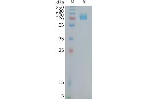 Human CD22(417-678) Protein, hFc Tag on SDS-PAGE under reducing condition.