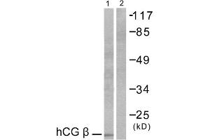 Western blot analysis of extracts from NIH/3T3 cells, using hCG beta antibody (ABIN5976419).