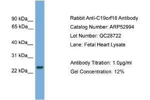 WB Suggested Anti-C19orf18  Antibody Titration: 0. (C19orf18 Antikörper  (N-Term))