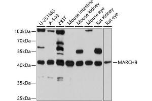 Western blot analysis of extracts of various cell lines, using M antibody (ABIN6130566, ABIN6143553, ABIN6143554 and ABIN6214902) at 1:1000 dilution. (MARCH9 Antikörper  (AA 277-346))
