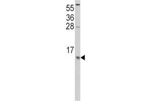 Western Blotting (WB) image for anti-Chemokine (C-C Motif) Ligand 2 (CCL2) antibody (ABIN3002757)