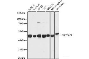 Western blot analysis of extracts of various cell lines using SLC25A24 Polyclonal Antibody at dilution of 1:1000. (SLC25A24 Antikörper)