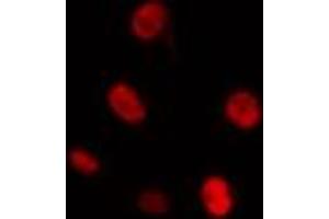 ABIN6274298 staining Hela cells by IF/ICC. (CKS1 Antikörper  (N-Term))