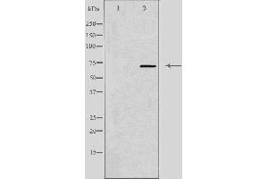 Western Blotting (WB) image for anti-Protein Phosphatase 2, Regulatory Subunit B', delta (PPP2R5D) (C-Term) antibody (ABIN6259114)