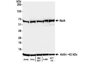 Western Blotting (WB) image for anti-Nuclear Factor-kB p65 (NFkBP65) (C-Term) antibody (ABIN7795799)