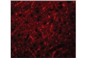 Immunofluorescence of PRDM16 in Human Brain cells with PRDM16 Antibody  at 20 µg/ml. (PRDM16 Antikörper  (C-Term))