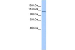 Western Blotting (WB) image for anti-Nucleoporin 155kDa (NUP155) antibody (ABIN2463616) (NUP155 Antikörper)