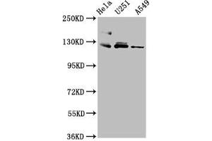 Western Blot Positive WB detected in: Hela whole cell lysate, U251 whole cell lysate, A549 whole cell lysate All lanes: FBLN2 antibody at 3. (FBLN2 Antikörper  (AA 301-440))