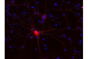 Indirect immunostaining of PFA fixed rat hippocampus neurons (dilution 1 : 500; red). (Calbindin D28k/D29k Antikörper)