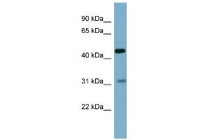 WB Suggested Anti-OMD Antibody Titration: 0. (Osteomodulin Antikörper  (Middle Region))