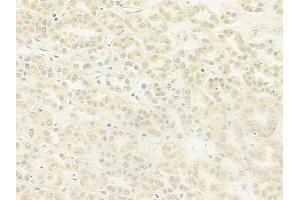 anti-Nucleolar Protein 8 (NOL8) (C-Term) antibody
