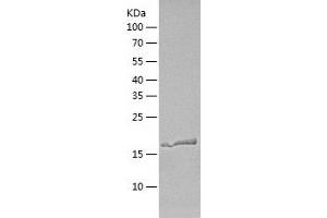 Retinoic Acid Early Transcript 1G (RAET1G) (AA 26-213) protein (His tag)