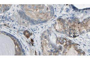 ABIN6275372 at 1/100 staining Human prostate tissue by IHC-P.