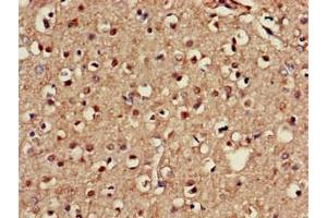 Immunohistochemistry of paraffin-embedded human brain tissue using ABIN7146747 at dilution of 1:100 (NOS1AP Antikörper  (C-Term))