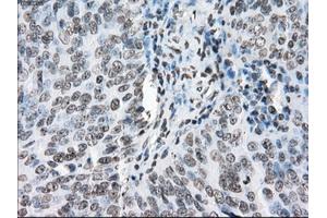 Immunohistochemical staining of paraffin-embedded endometrium tissue using anti-PORmouse monoclonal antibody. (POR Antikörper)