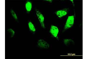 Immunofluorescence of monoclonal antibody to TCF4 on HeLa cell. (TCF4 Antikörper  (AA 1-365))