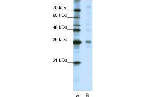 WB Suggested Anti-CRSP8 Antibody Titration:  5.