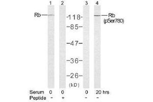 Image no. 2 for anti-Retinoblastoma 1 (RB1) (Ser780) antibody (ABIN197285) (Retinoblastoma 1 Antikörper  (Ser780))