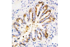 Anti-Calpain 1 antibody, IHC(P) IHC(P): Rat Lung Tissue (CAPNL1 Antikörper  (Middle Region))
