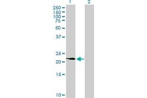 Western Blot analysis of PDGFA expression in transfected 293T cell line by PDGFA MaxPab polyclonal antibody. (PDGFA Antikörper  (AA 1-211))
