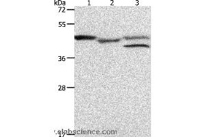 Western blot analysis of K562 cell and mouse heart tissue, MCF7 cell, using PSMD6 Polyclonal Antibody at dilution of 1:900 (PSMD6 Antikörper)