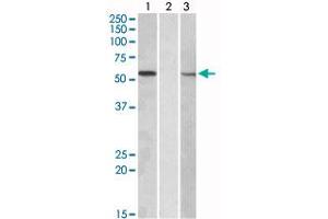 HEK293 lysate (10 ug protein in RIPA buffer) overexpressing human MGAT1 with C-terminal MYC tag probed with MGAT1 polyclonal antibody (Cat # PAB18956, 1 ug/mL) in Lane A and probed with anti-MYC Tag (1/1000) in lane C. (MGAT1 Antikörper  (Internal Region))
