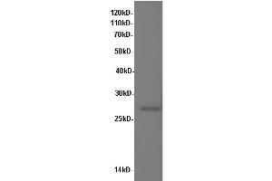 Western Blotting (WB) image for anti-Interleukin 10 (IL10) antibody (ABIN5957052) (IL-10 Antikörper)