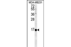 NMB Antibody (Center) (ABIN651541 and ABIN2840290) western blot analysis in MDA-M cell line lysates (35 μg/lane).