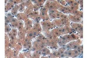 Immunohistochemistry (IHC) image for anti-Matrix Metallopeptidase 12 (Macrophage Elastase) (MMP12) (AA 290-469) antibody (ABIN7431749)