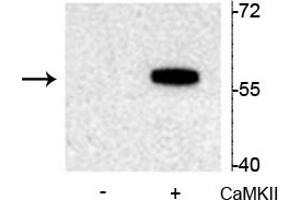 Western blot of recombinant tryptophan hydroxylase incubated in the absence (-) and presence (+) of  Ca2+/calmodulin dependent kinase II showing specific immunolabeling of the ~55 kDa tryptophan hydroxylase protein phosphorylated at Ser19. (Tryptophan Hydroxylase 2 Antikörper  (pSer19))