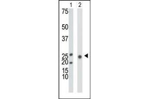 The anti-KHK Pab is used in Western blot to detect KHK in mouse liver tissue lysate (Lane 1) and 293 cell lysate (Lane 2).
