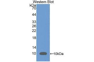 Western blot analysis of the recombinant protein. (C5A Antikörper  (AA 679-755))